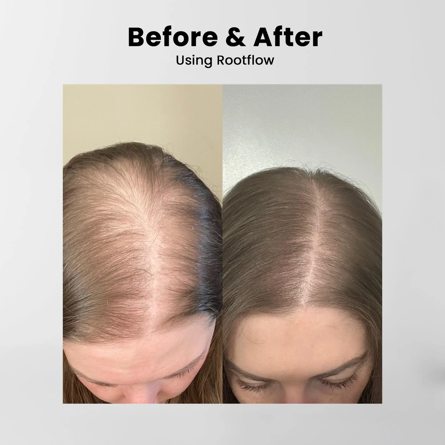 Rootflow Scalp Treatment