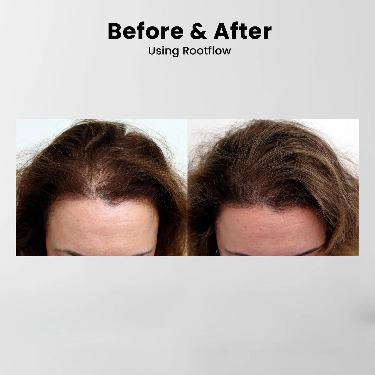 Rootflow Scalp Treatment