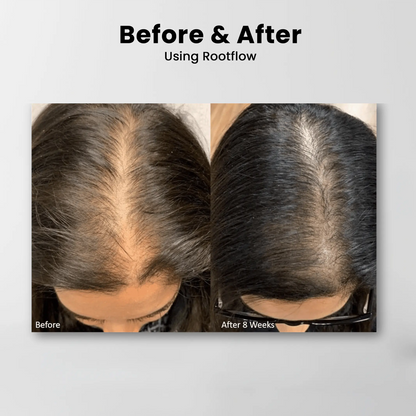 Rootflow Scalp Treatment