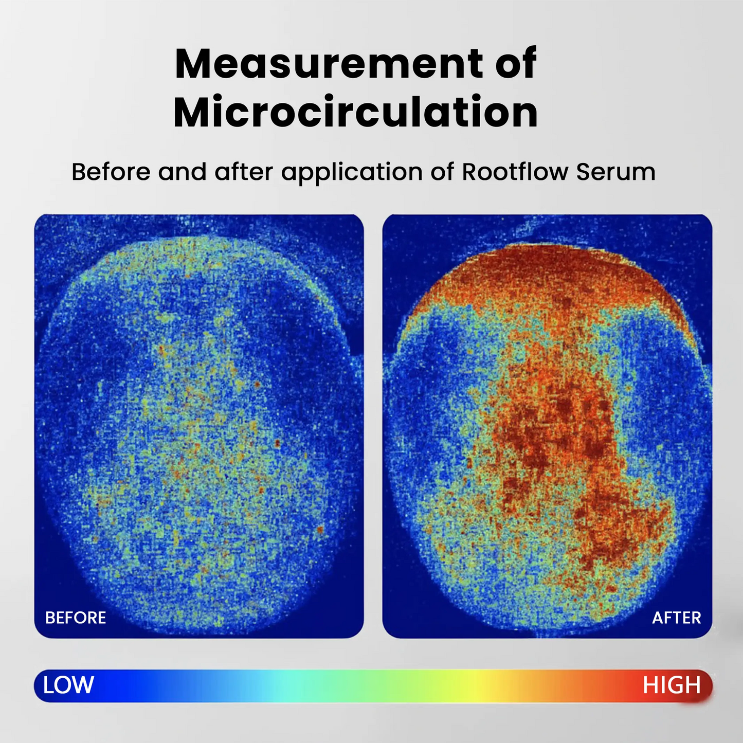 Rootflow Scalp Treatment