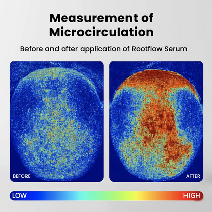 Rootflow Scalp Treatment